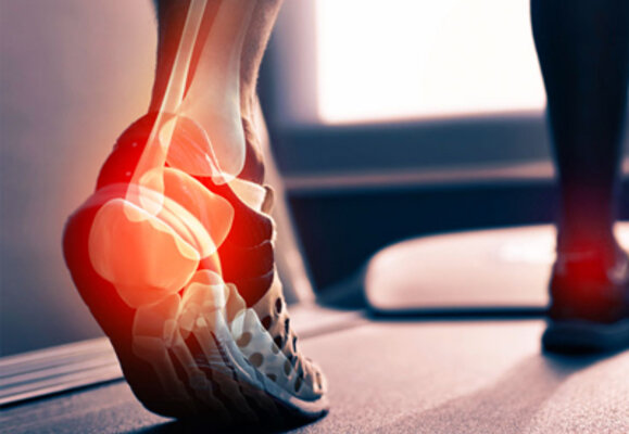 Achilles Tendonitis